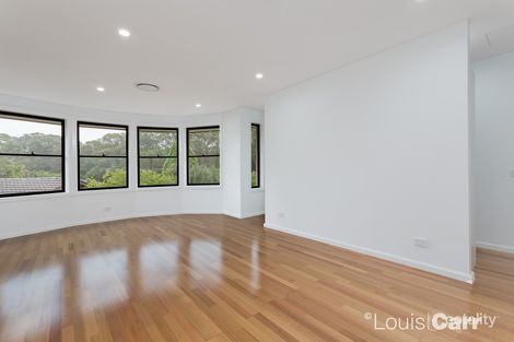 Property photo of 147A Oratava Avenue West Pennant Hills NSW 2125