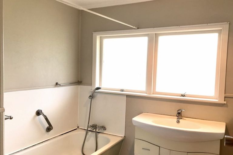 Photo of property in 71 Lawrence Crescent, Hillpark, Auckland, 2102